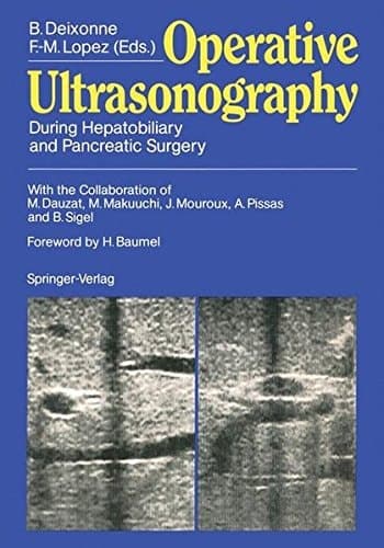 Operative Ultrasonography During Hepatobiliary and Pancreatic Surgery
