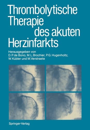 Thrombolytische Therapie des akuten Herzinfarkts (German Edition)
