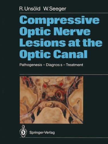 Compressive Optic Nerve Lesions at the Optic Canal Pathogenesis – Diagnosis – Treatment