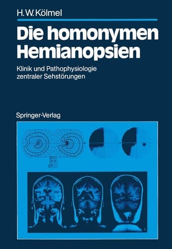Die homonymen Hemianopsien Klinik und Pathophysiologie zentraler Sehstörungen
