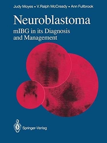 Neuroblastoma mIBG in its Diagnosis and Management