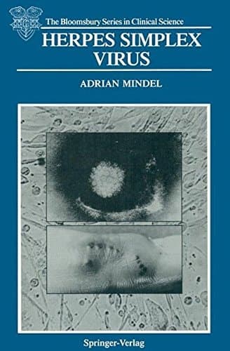 Herpes Simplex Virus (The Bloomsbury Series in Clinical Science)