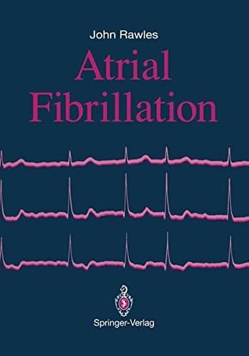 Atrial Fibrillation