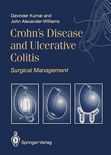 Crohn’s Disease and Ulcerative Colitis Surgical Management