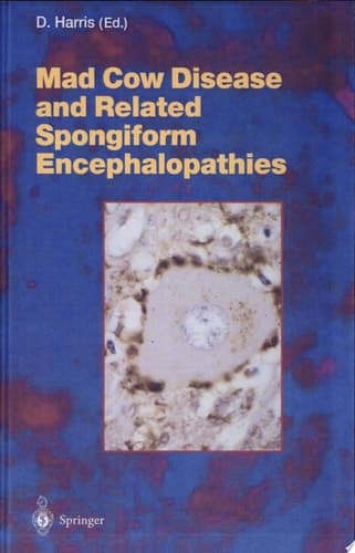 Mad Cow Disease and Related Spongiform Encephalopathies