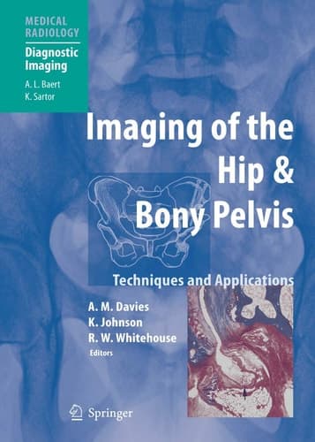 Imaging of the Hip & Bony Pelvis Techniques and Applications