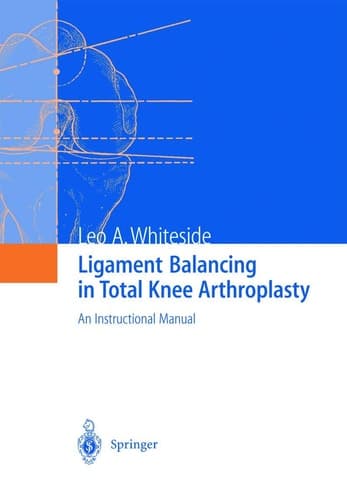 Ligament Balancing in Total Knee Arthroplasty: An Instructional Manual