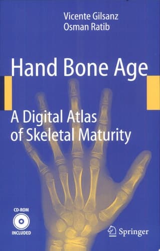 Hand Bone Age A Digital Atlas Of Skeletal Maturity
