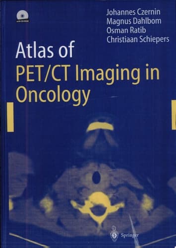 Atlas of PET/CT Imaging in Oncology 13 Tables