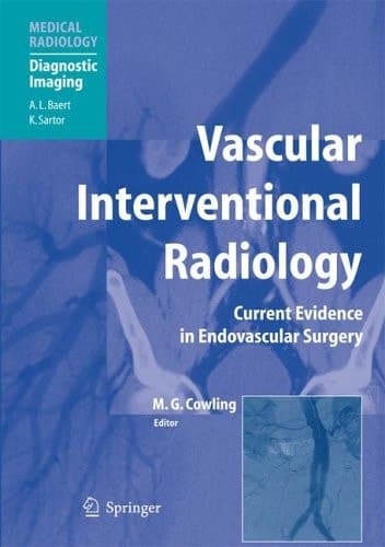 Vascular Interventional Radiology Angioplasty, Stenting, Thrombolysis and Thrombectomy