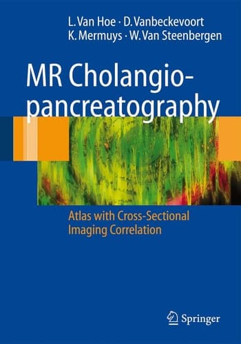 MR Cholangiopancreatography Atlas with Cross-Sectional Imaging Correlation
