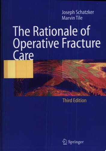 The Rationale of Operative Fracture Care