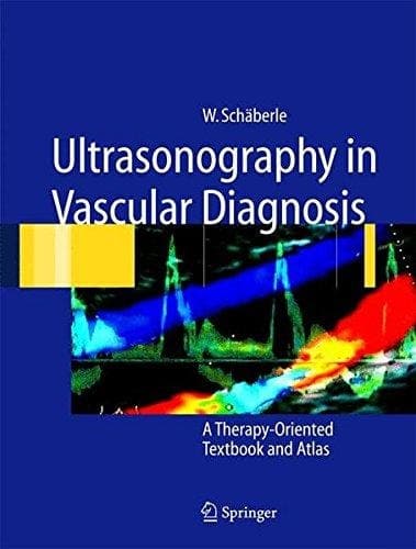 Ultrasonography in Vascular Diagnosis A Therapy-Oriented Textbook and Atlas