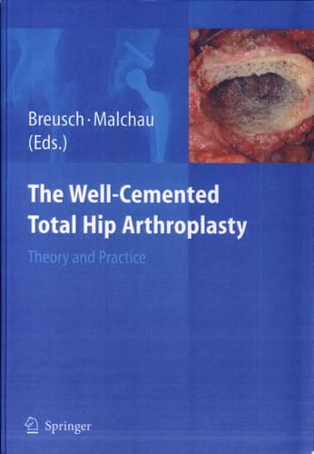 The Well-Cemented Total Hip Arthroplasty Theory and Practice