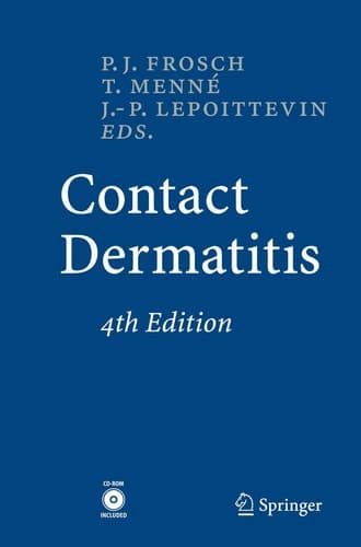 Contact Dermatitis With 180 Tables