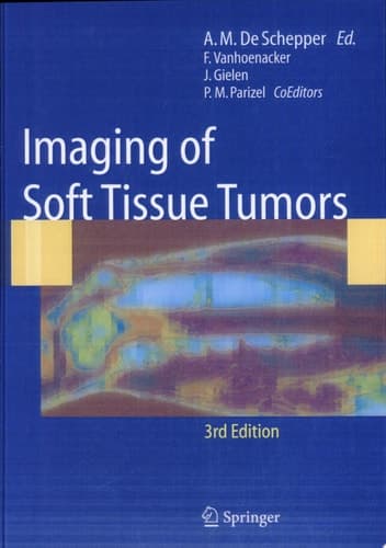 Imaging of Soft Tissue Tumors