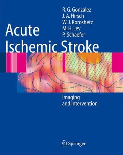 Acute Ischemic Stroke Imaging and Intervention