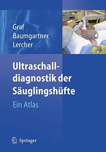 Ultraschalldiagnostik der Säuglingshüfte Ein Atlas