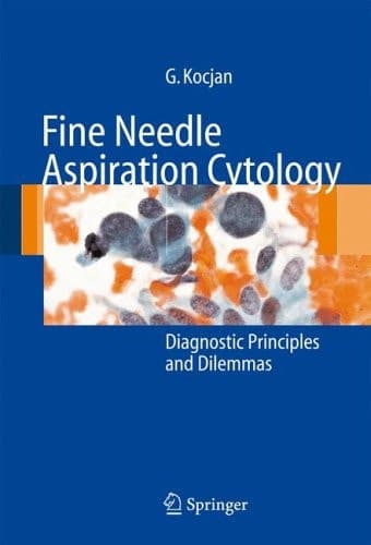 Fine Needle Aspiration Cytology Diagnostic Principles and Dilemmas