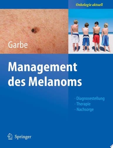 Management Des Melanoms