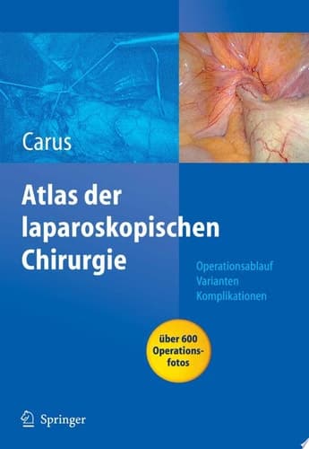 Atlas Der Laparoskopischen Chirurgie Operationsablauf - Varianten - Komplikationen