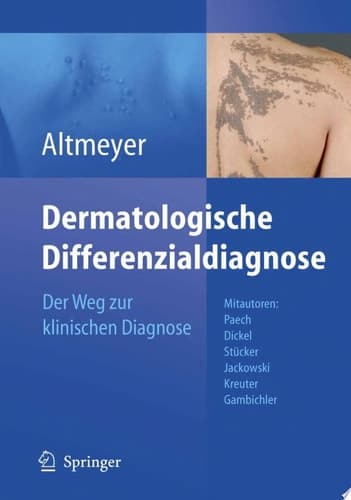 Dermatologische Differenzialdiagnose Der Weg zur klinischen Diagnose