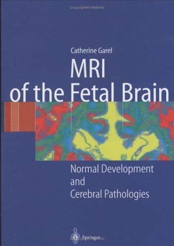 MRI of the Fetal Brain Normal Development and Cerebral Pathologies
