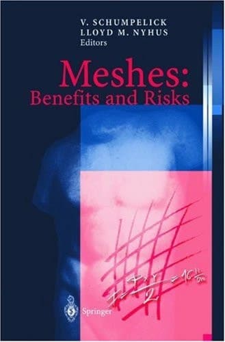 Meshes: Benefits and Risks