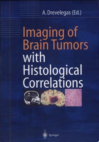 Imaging of Brain Tumors with Histological Correlations