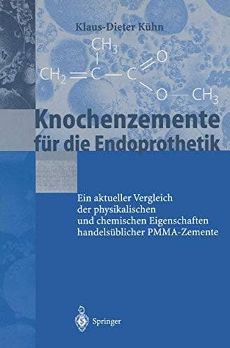 Knochenzemente für die Endoprothetik Ein aktueller Vergleich der physikalischen und chemischen Eigenschaften handelsüblicher PMMA-Zemente
