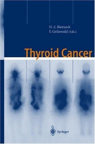 Thyroid Cancer