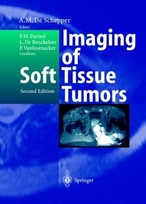 Imaging of Soft Tissue Tumors