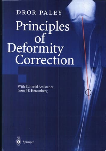 Principles of Deformity Correction