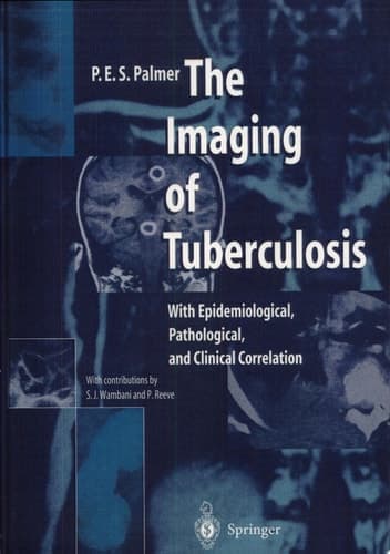 The Imaging of Tuberculosis With Epidemiological, Pathological, and Clinical Correlation
