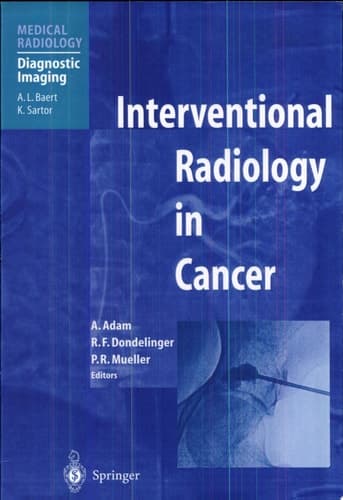 Interventional Radiology in Cancer