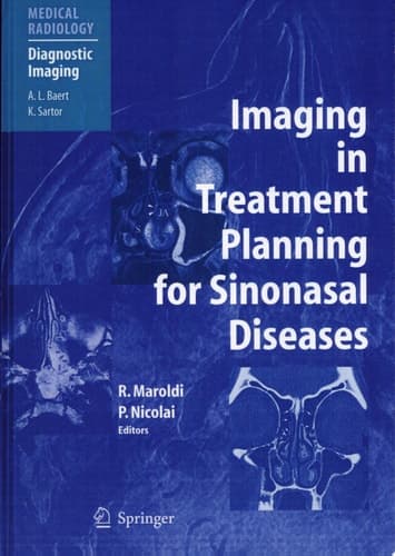 Imaging in Treatment Planning for Sinonasal Diseases