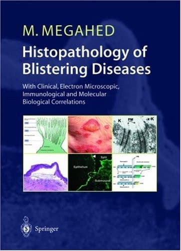 Histopathology of Blistering Diseases With Clinical, Electron Microscopic, Immunological, and Molecular Biological Correlations : Textbook and Atlas
