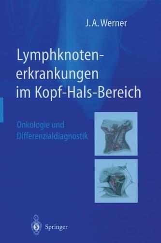 Lymphknoten-Erkrankungen im Kopf-Hals-Bereich Onkologie und Differenzialdiagnostik ; mit 42 Tabellen