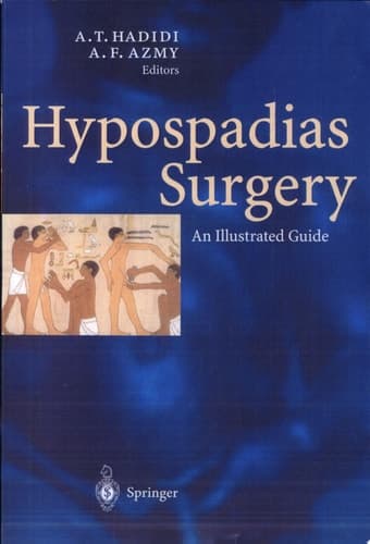 Hypospadias Surgery An Illustrated Guide
