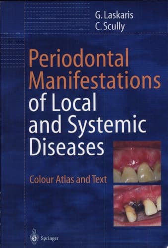 Periodontal Manifestations of Local and Systemic Diseases Colour Atlas and Text ; 8 Tables