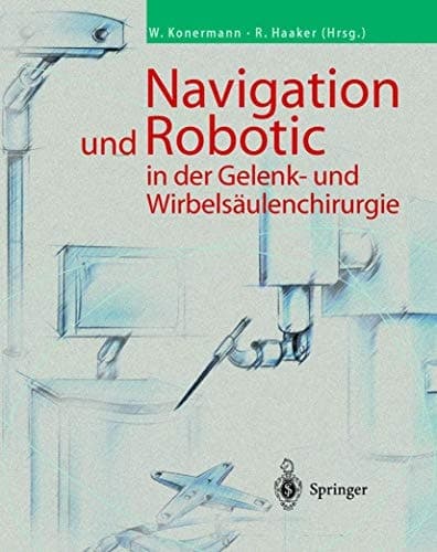 Navigation und Robotic in der Gelenk- und Wirbelsäulenchirurgie mit 33 Tabellen