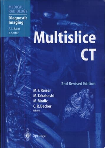 Multislice CT