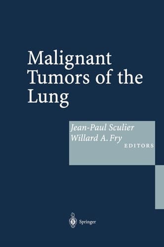 Malignant Tumors of the Lung Evidence-based Management