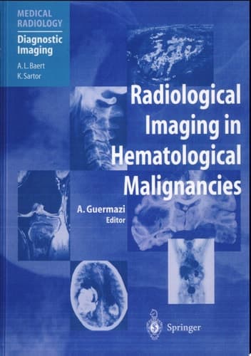 Radiological Imaging in Hematological Malignancies With 21 Tables