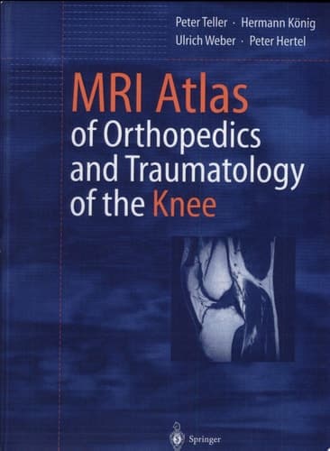 MRI Atlas of Orthopedics and Traumatology of the Knee