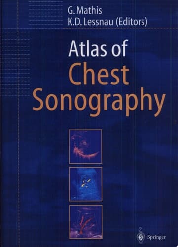 Atlas of Chest Sonography