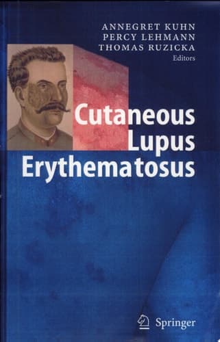 Cutaneous Lupus Erythematosus