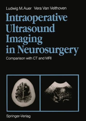 Intraoperative Ultrasound Imaging in Neurosurgery Comparison with CT and MRI