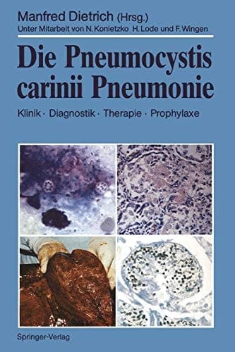 Die Pneumocystis carinii Pneumonie Klinik · Diagnostik · Therapie · Prophylaxe