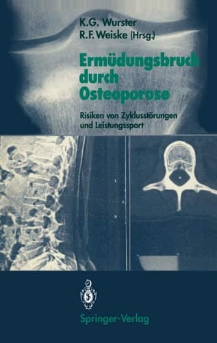 Ermüdungsbruch durch Osteoporose Risiken von Zyklusstörungen und Leistungssport